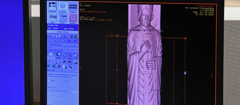 Hochauflösend zeigt der Computertomograph den Frankenapostel Kilian an.