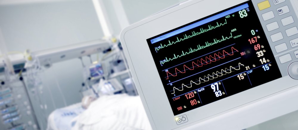 Ein Monitor im Krankenhaus zeigt den Herzrhythmus und Blutdruck eines Patienten.
