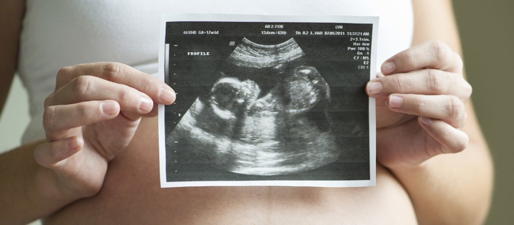 Eine schwangere Frau hält ein Ultraschallbild ihres ungeborenen Kindes.