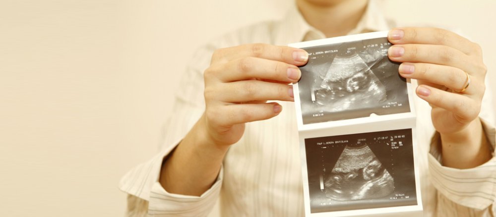 Das Ultraschallbild eines Babys im Bauch der Mutter.