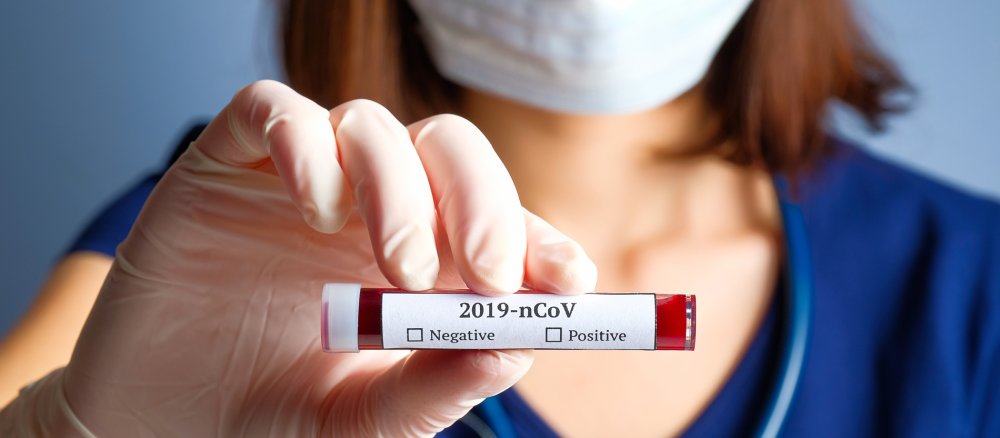 Bluttest Coronavirus