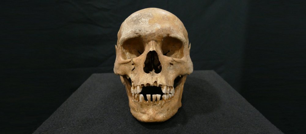 Ein Schädel, der von einem Mönch aus dem Kloster Lorsch stammt