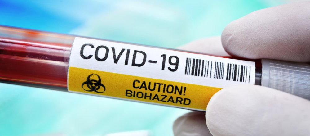 Ein Test auf das Coronavirus