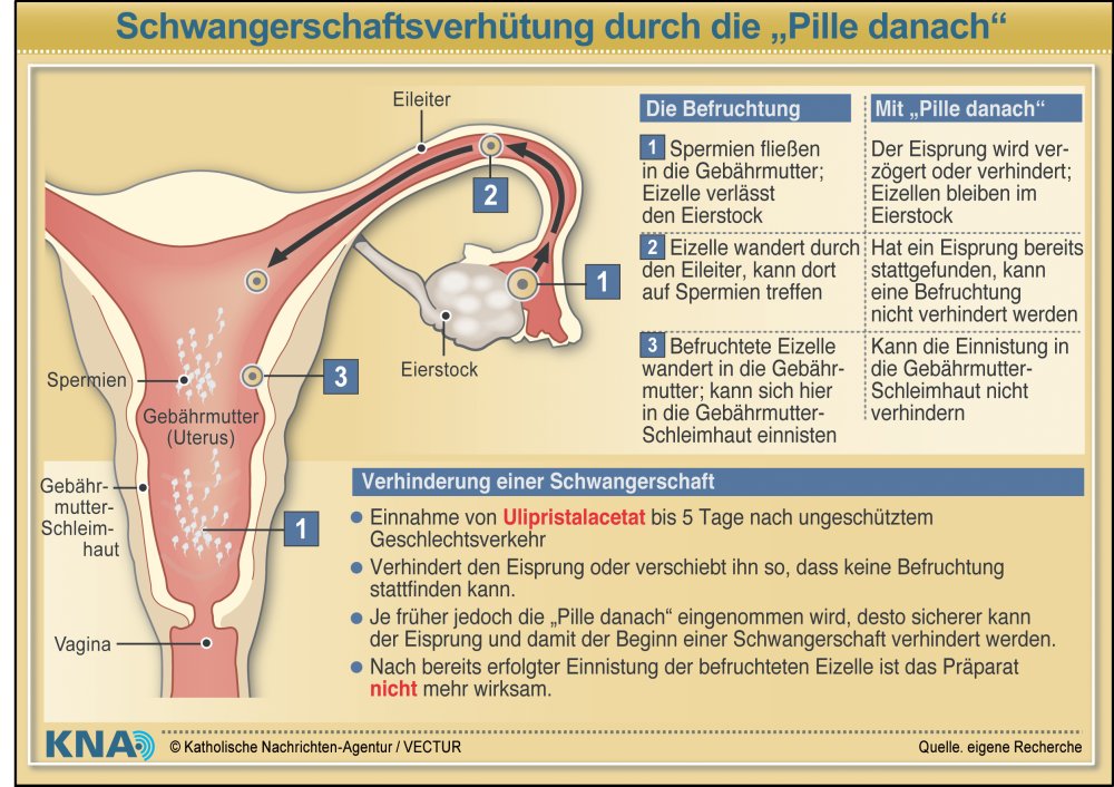 Schwangerschaftsverhütung durch die "Pille danach".