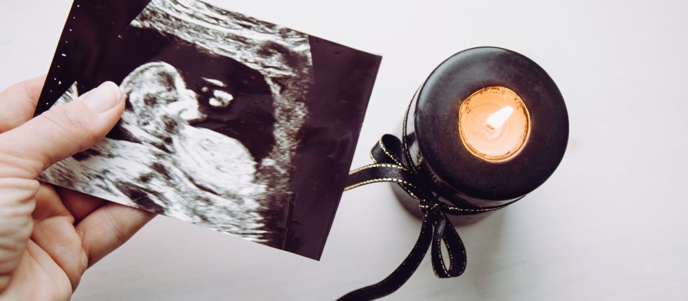 Eine Mutter hält das Ultraschallbild ihres Babys in der Hand.